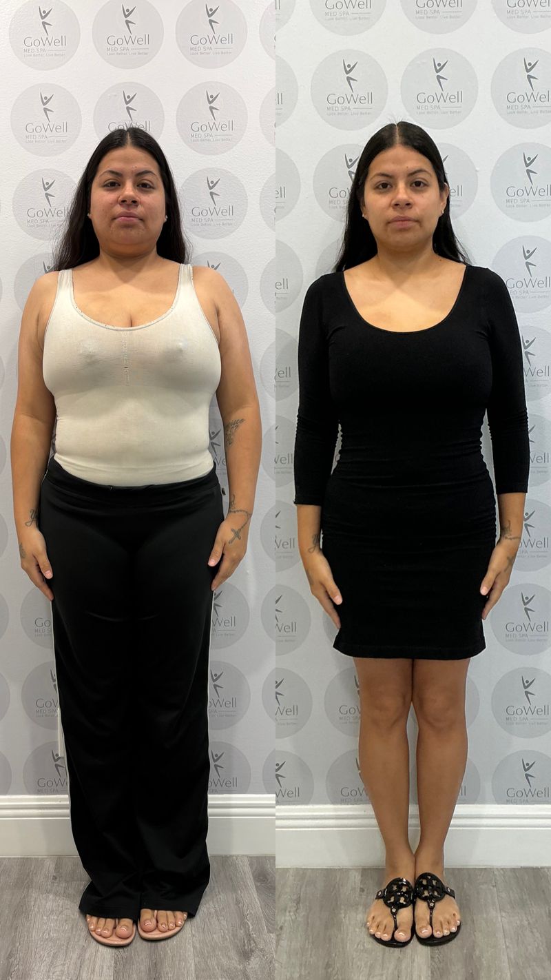 GoWell client before and after the medical weight loss program