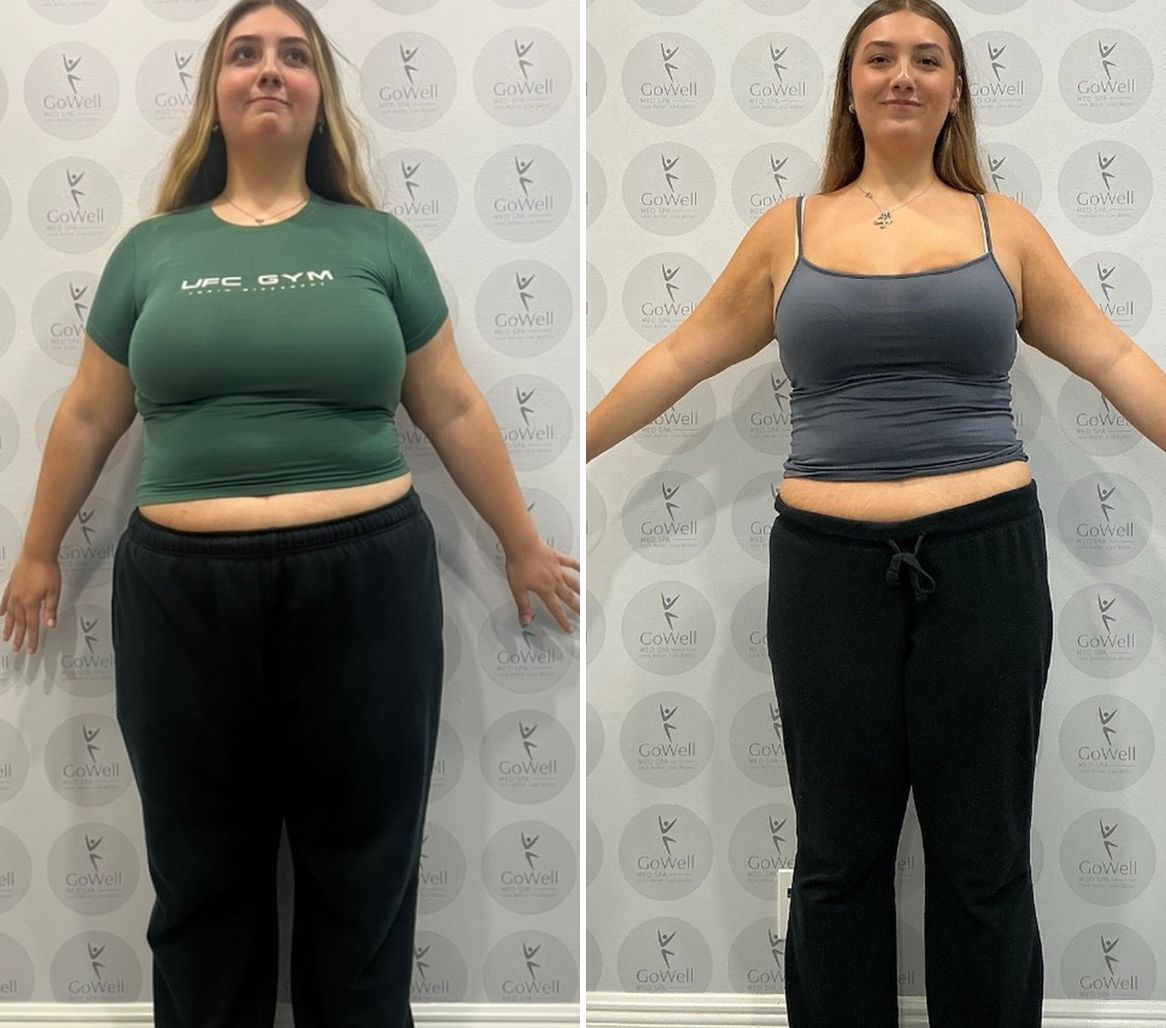 Before and after — front view